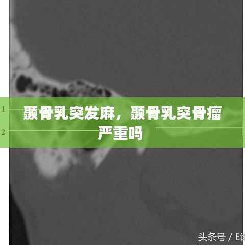 颞骨乳突发麻,颞骨乳突骨瘤严重吗