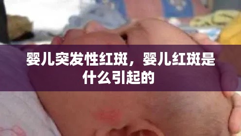 婴儿突发性红斑,婴儿红斑是什么引起的